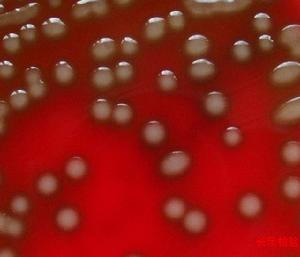 供应生物肥料功能菌种 生物有机肥菌种